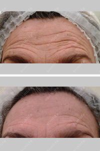 anti-aging_011