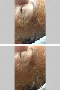 anti_aging-019